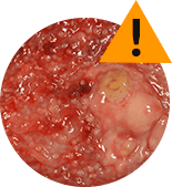 Cystiolla