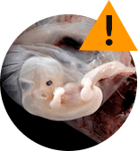 Cystiolla
